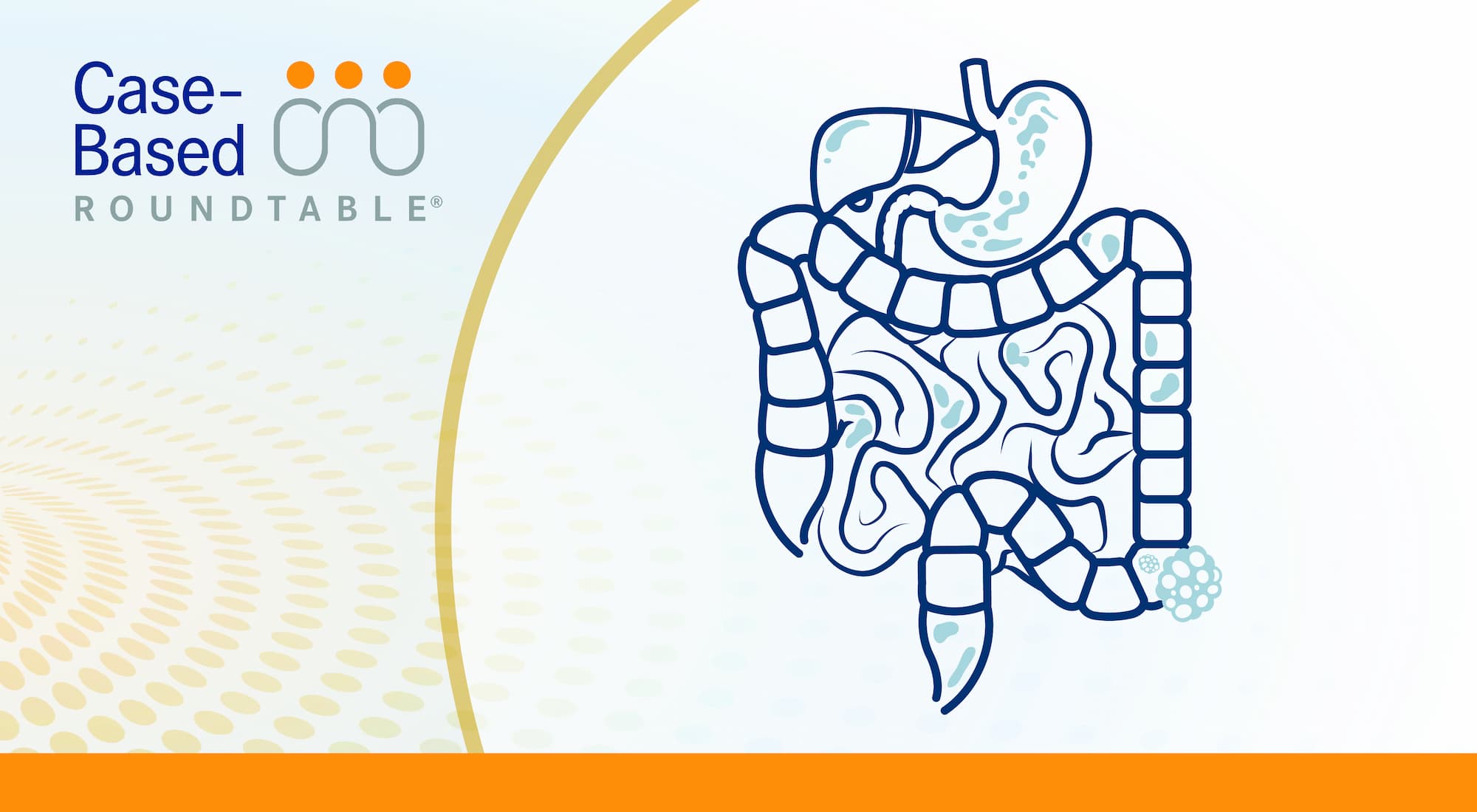 NALIRIFOX Dose Reductions Maintain Efficacy in Pancreatic Cancer