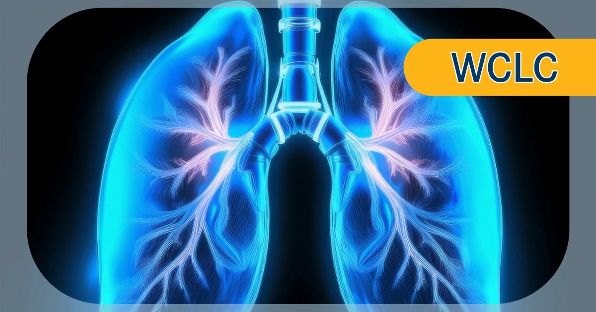 Aumolertinib Plus Chemotherapy Improves PFS in EGFR-Mutated NSCLC
