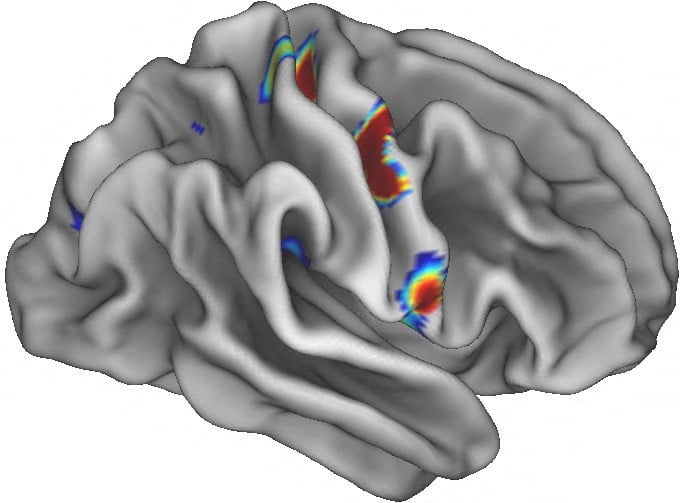 Three coloured spots on half of the brain illuminate special locations in the movement areas of the brain that connect to areas involved in thinking, planning and control of basic bodily functions such as heart rate, in an undated illustration. Source: REUTERS