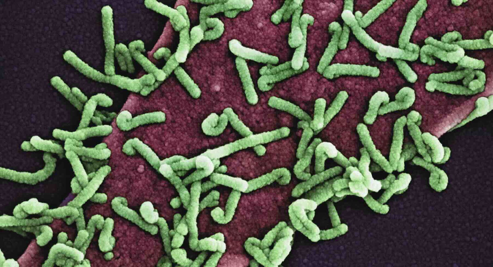Scientists Fear “Mirror Life” Synthetically Produced in the Lab Could Create a Dangerous New Form of Biology