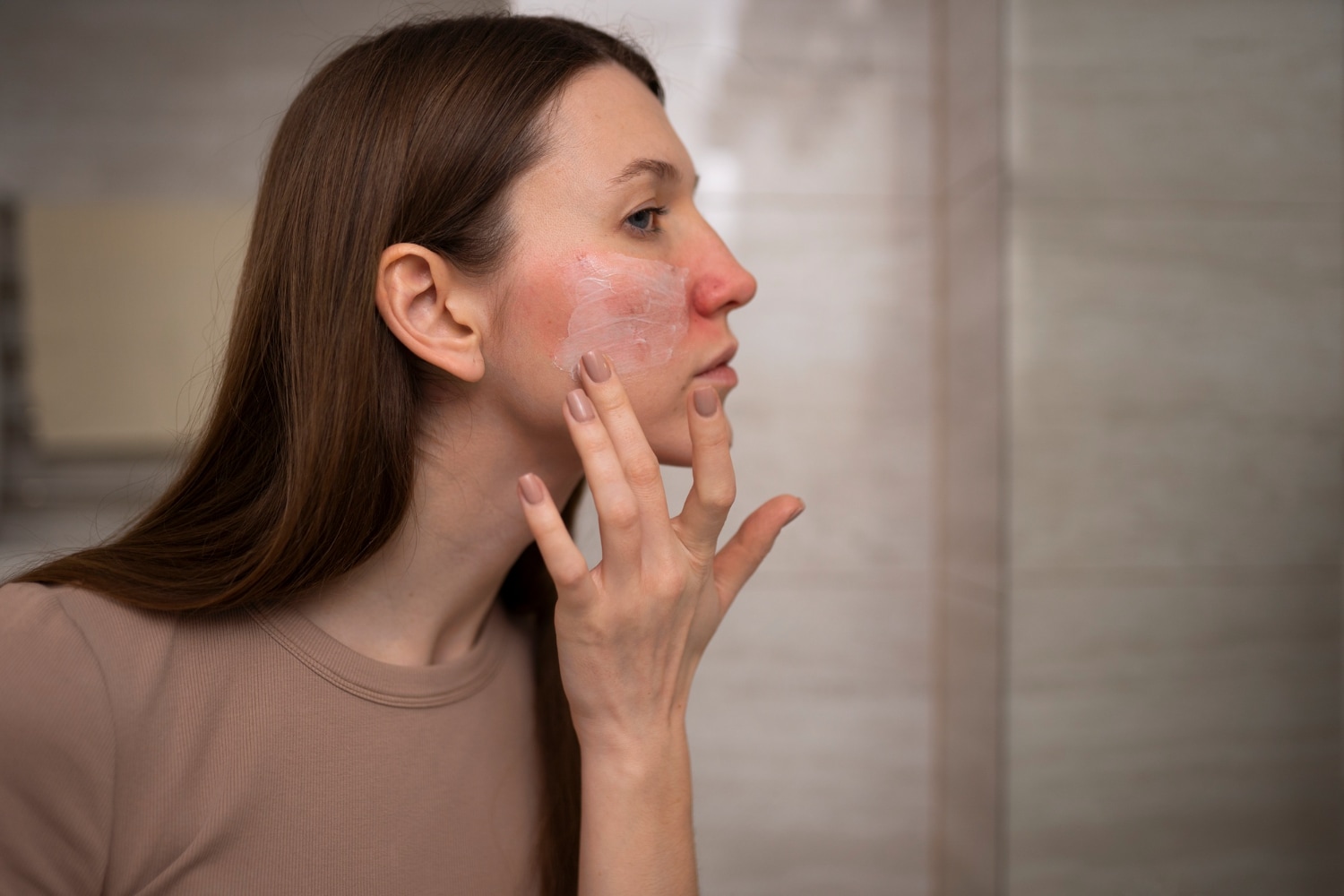 One of the signs of eczema is frequently inflamed skin.(Shutterstock)