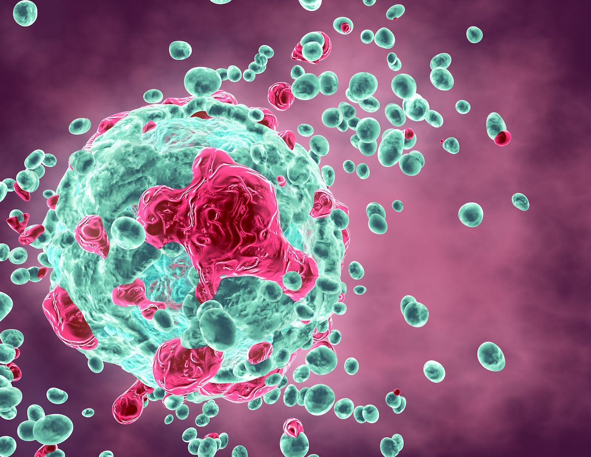 Adjuvant Chemotherapy Improves Long-Term Survival in Endometrial Cancer