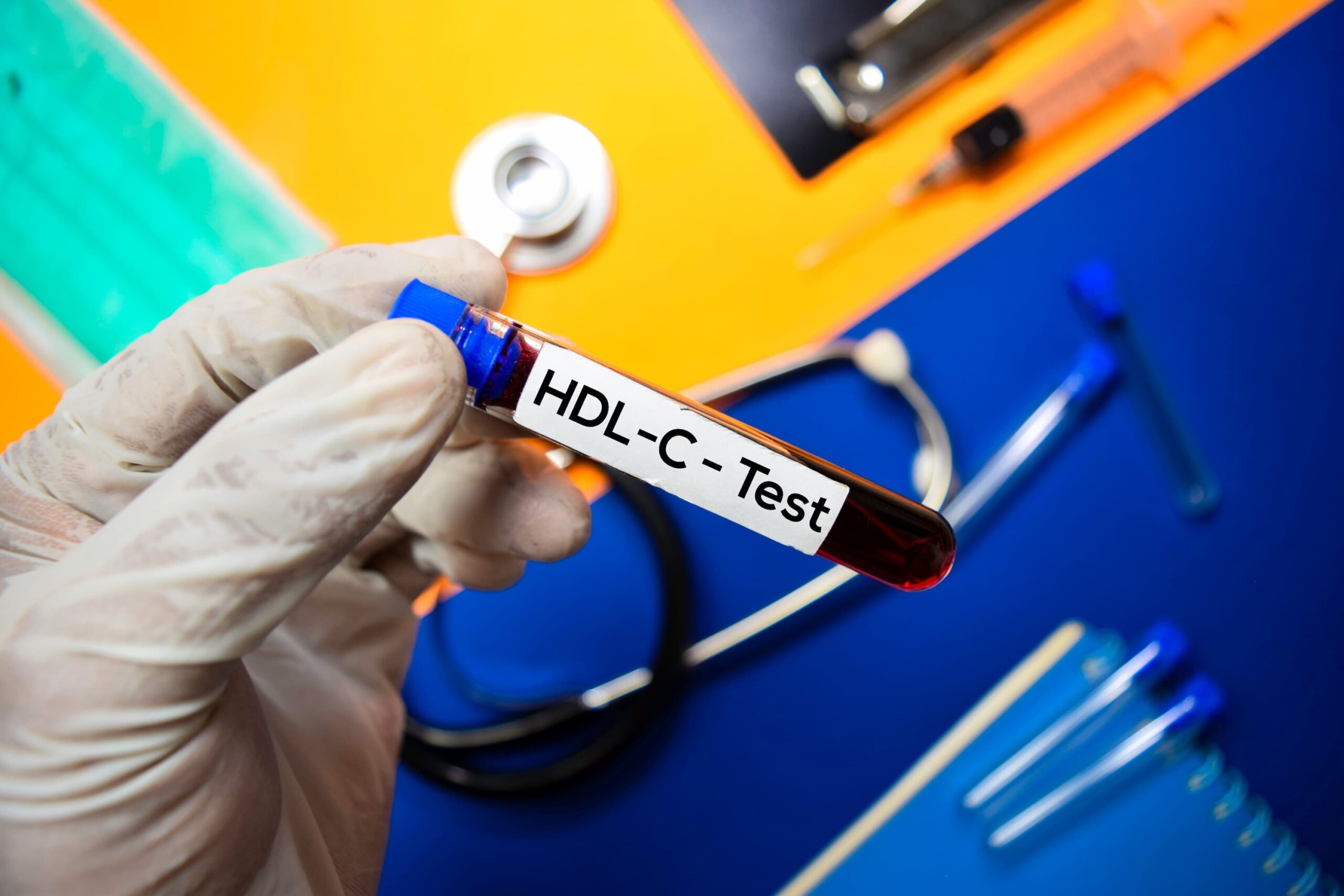 HDL-C-to-LDL-C Ratio Can Predict Prognosis of High-Risk CVD Individuals
