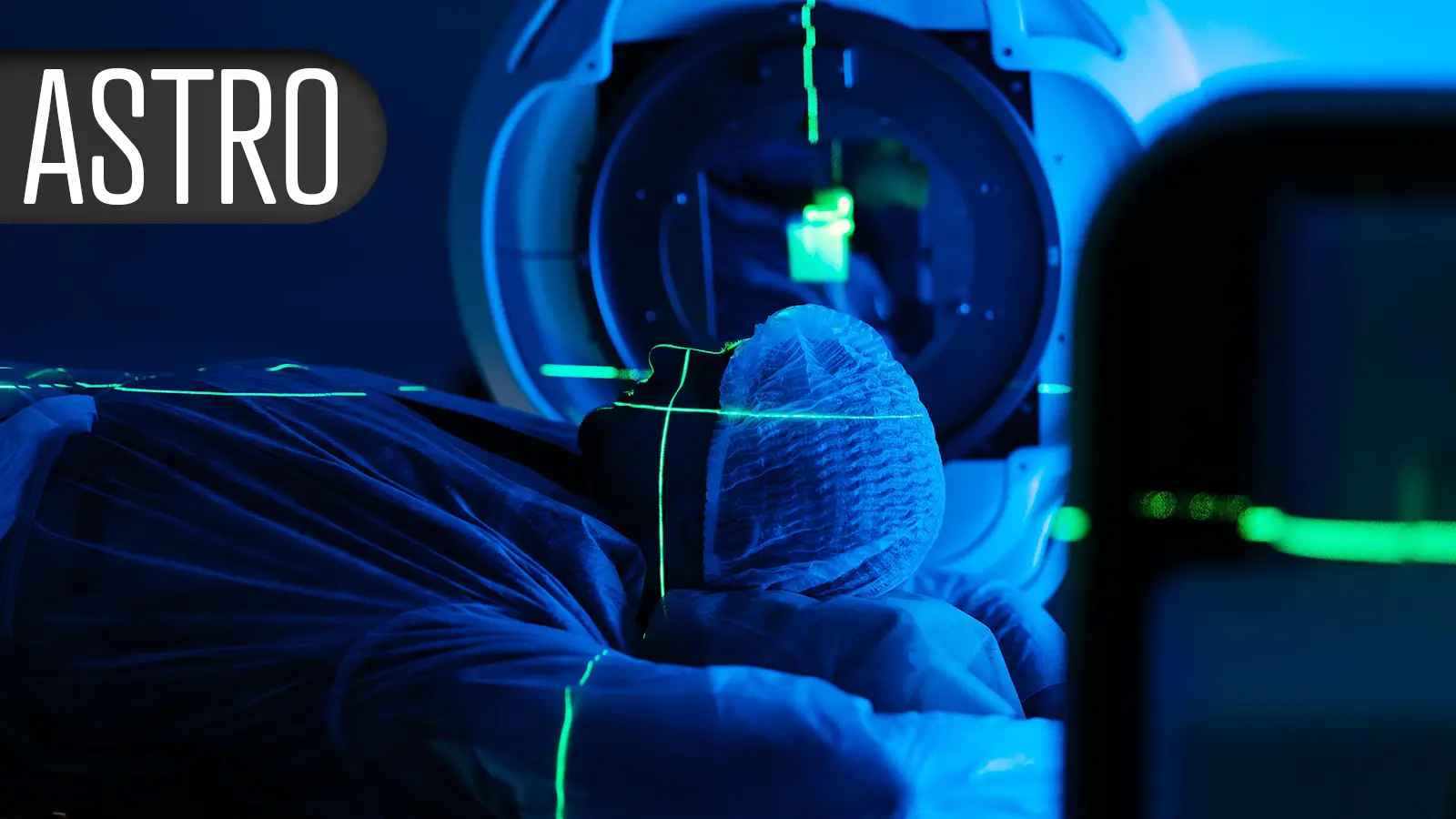 Survival Benefit Evades Pelvic Radiation in Less Aggressive Prostate Cancer