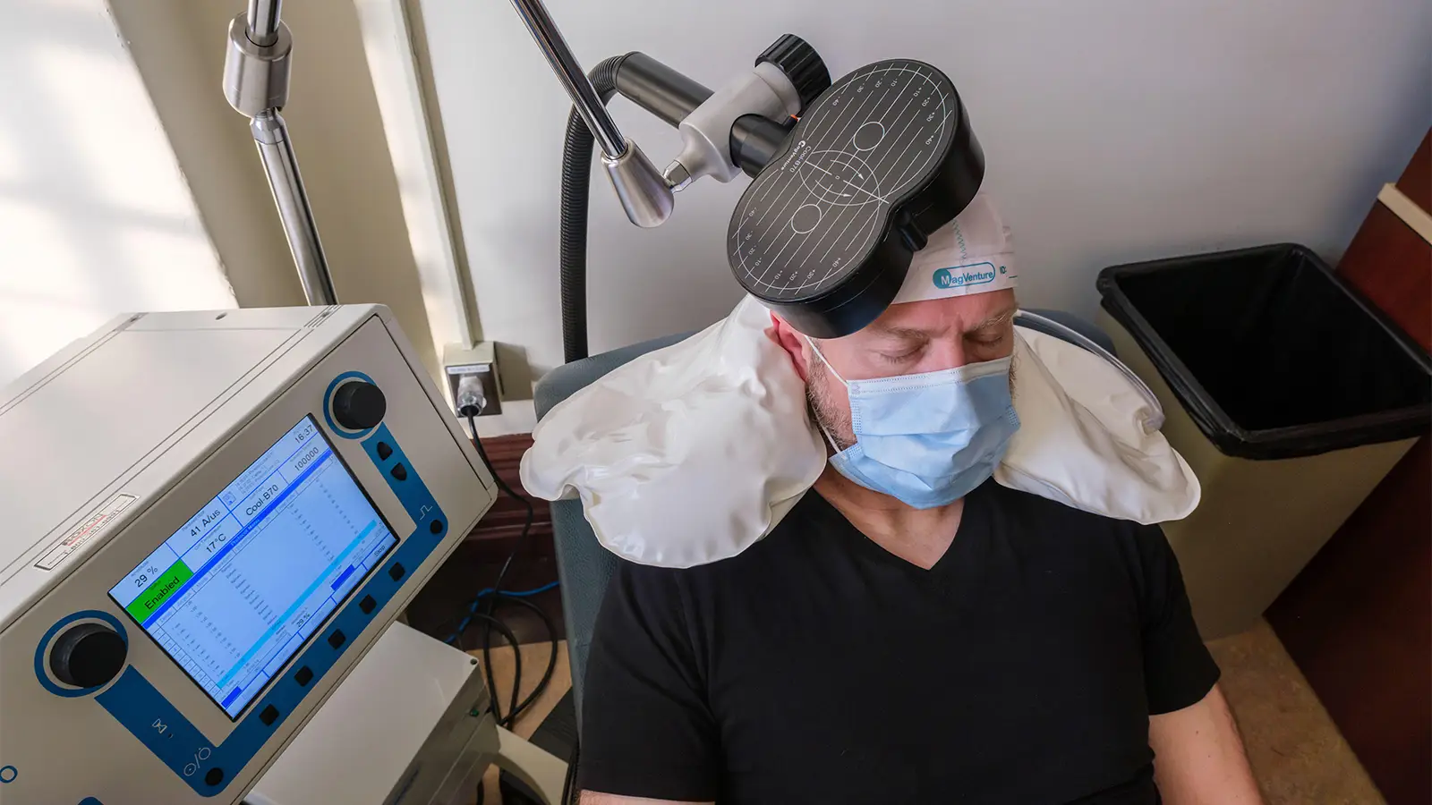 In Brain Stim for Depression, Early Heart Rate Changes May Signal Response