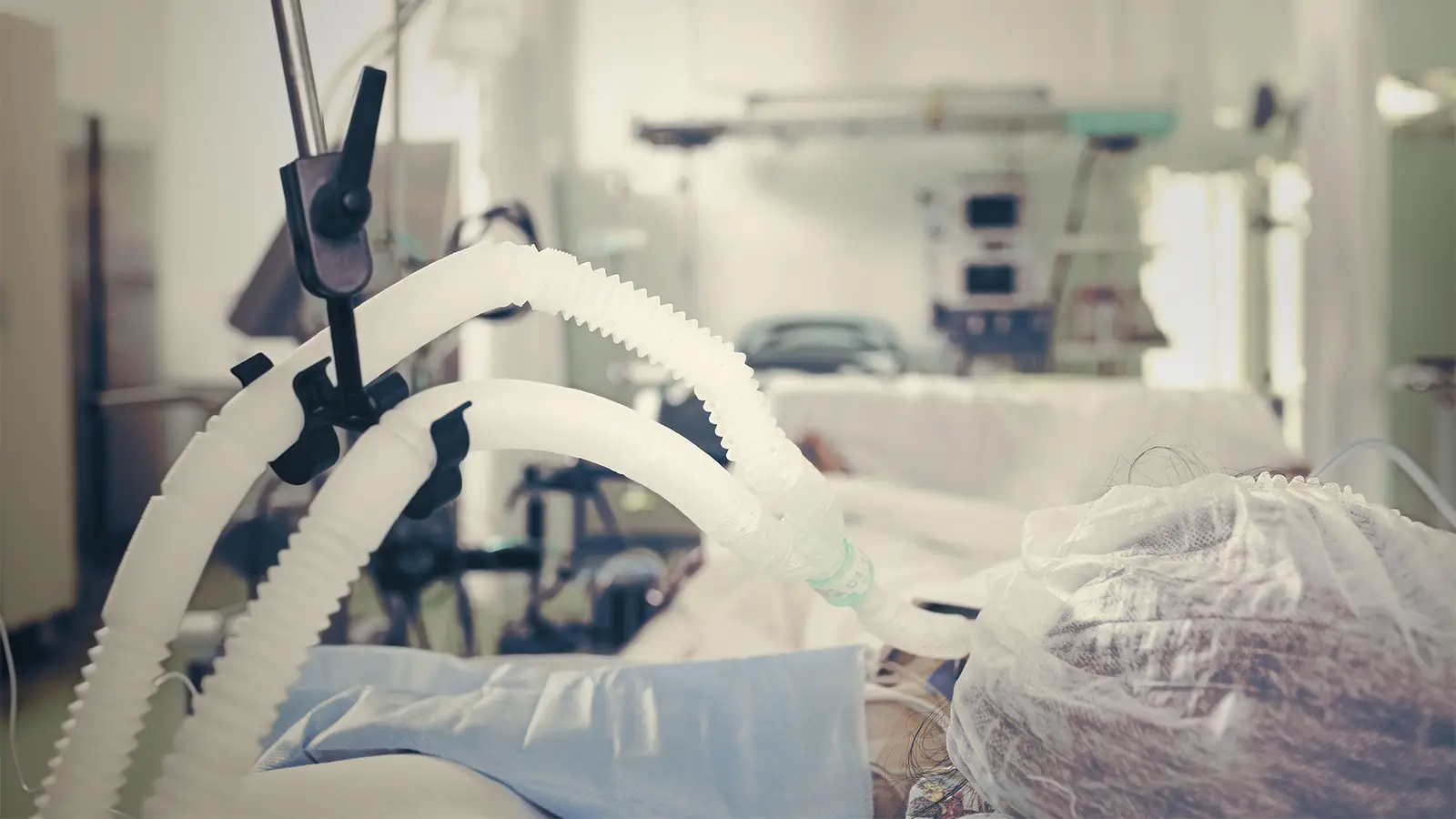 ICU Deep Sedation Linked to Loss of Independent Living