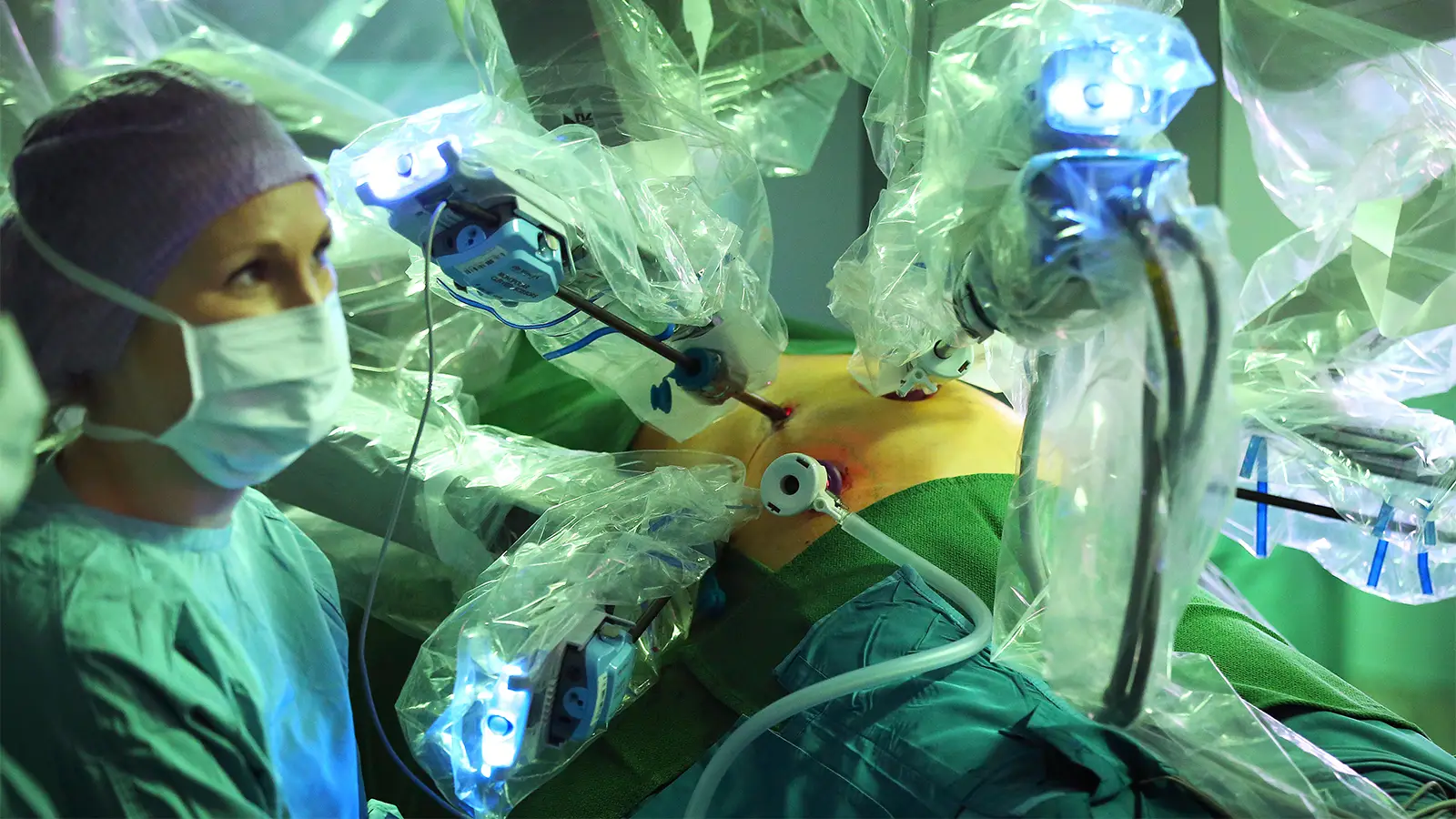 Patients With Pancreatic Cancer May Live Longer With Surgery Alone — With a Catch