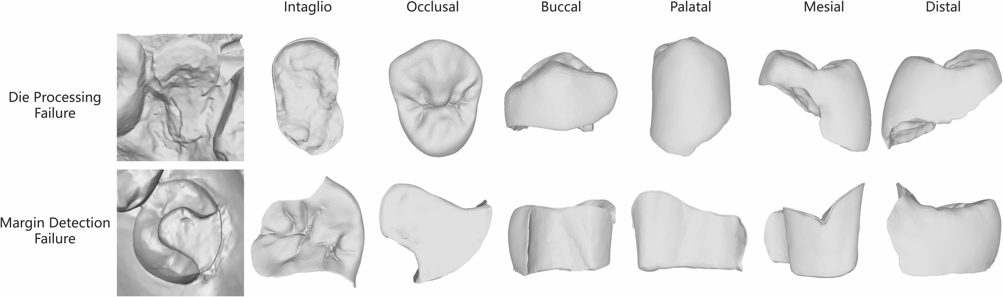 Morphological comparison between artificial intelligence-driven and manual CAD design in single tooth restoration: a preliminary study | BMC Oral Health