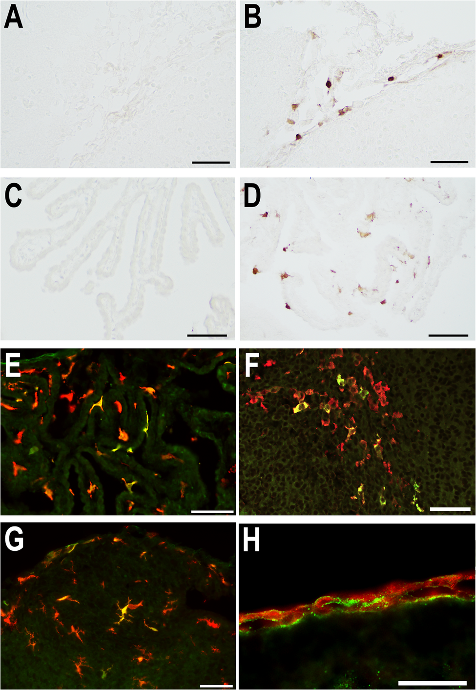 Early immune responses to systemic inflammation in the postnatal mouse brain initiated by migrating macrophages and leptomeningeal fibroblasts | Journal of Neuroinflammation