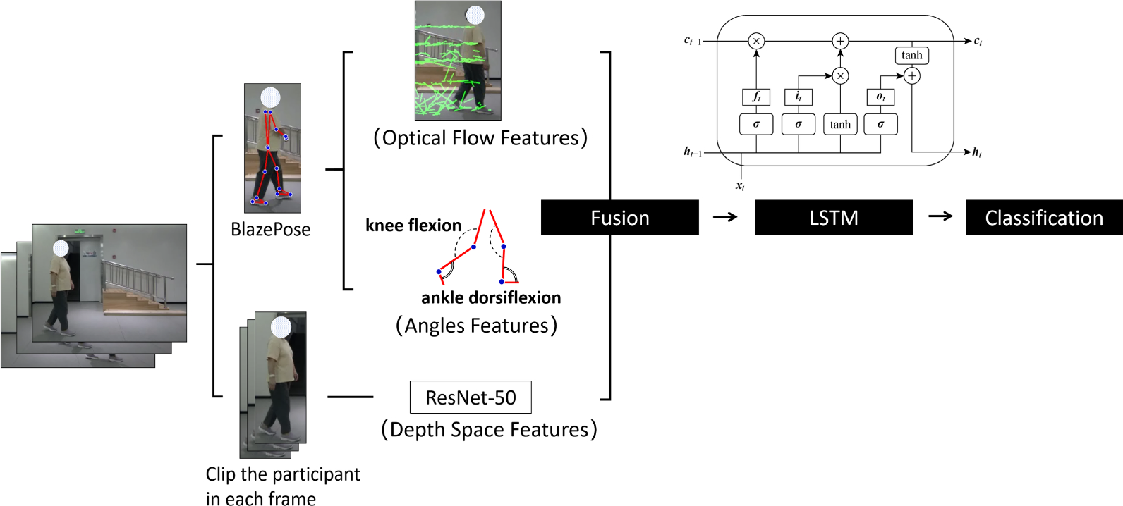 Differentiating post-stroke patients from healthy individuals via vision-based skeleton-optical fusion | Journal of NeuroEngineering and Rehabilitation
