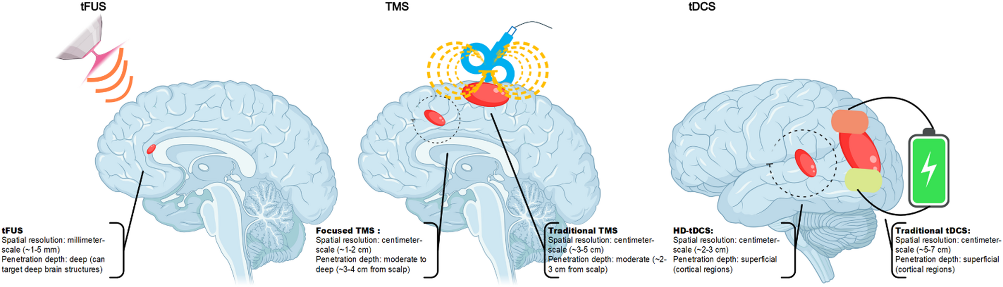 A panoramic review of transcranial focused ultrasound neuromodulation: from basic research to clinical applications | Journal of NeuroEngineering and Rehabilitation