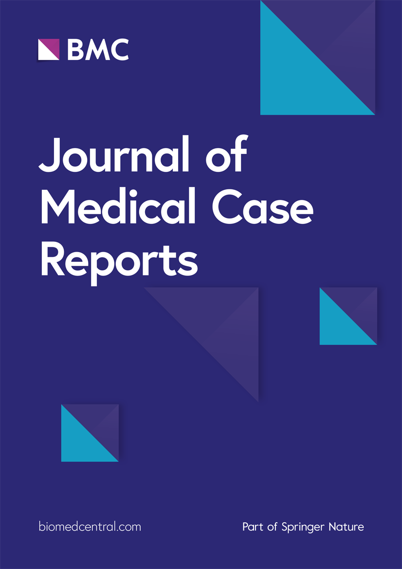 Transient epileptic amnesia: temporal progression of partially treated disease—a case report | Journal of Medical Case Reports