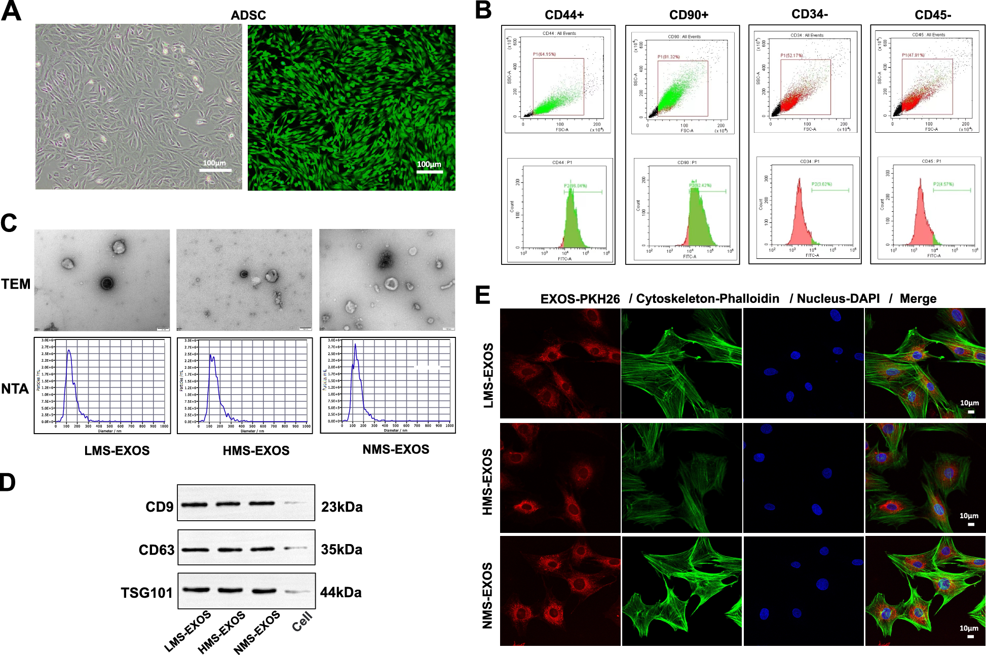 MiR-877, an exosomal miRNA from mechanical stretch induced adipose derived stromal cells, enhances fracture healing in nonunion rats with type 2 diabetes mellitus | Stem Cell Research & Therapy