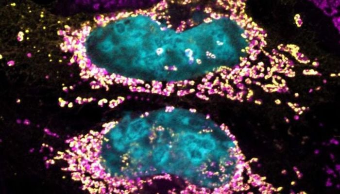 Scientists discover bacterial protein making cancer cells self-destruct