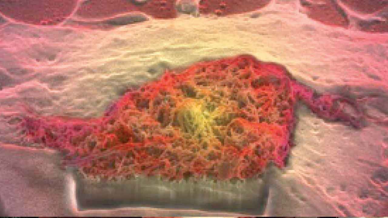 Problems with brain’s waste clearance can contribute to dementia