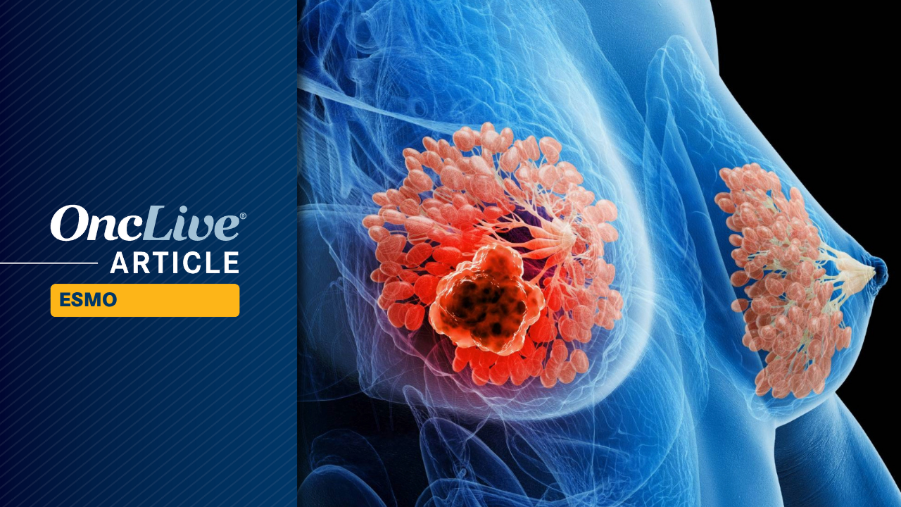 Adjuvant Ribociclib Plus AI Therapy Has Long-Term Activity in HR+, HER2-Negative Early Breast Cancer