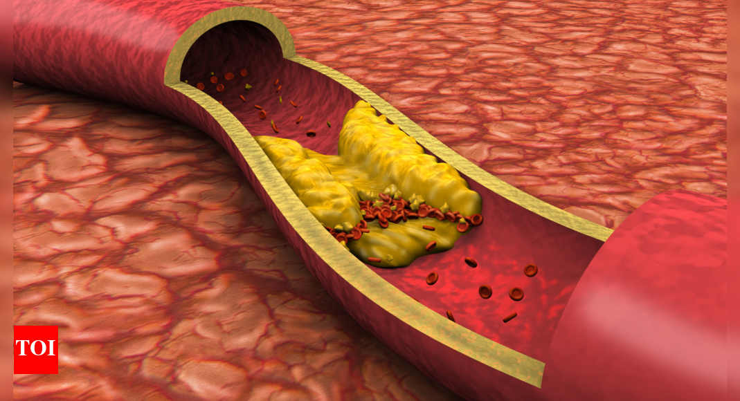 4 everyday drinks that can help prevent artery plaque, and improve blood flow