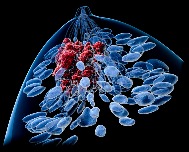 Targeted Combos and ADCs Show Benefit After CDK4/6 in HR+/HER2− mBC