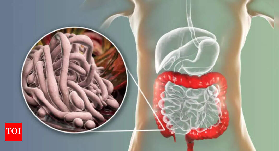Intestinal Parasites Symptoms: Do you have intestinal parasites? Gastroenterologist shares common symptoms to be aware of |