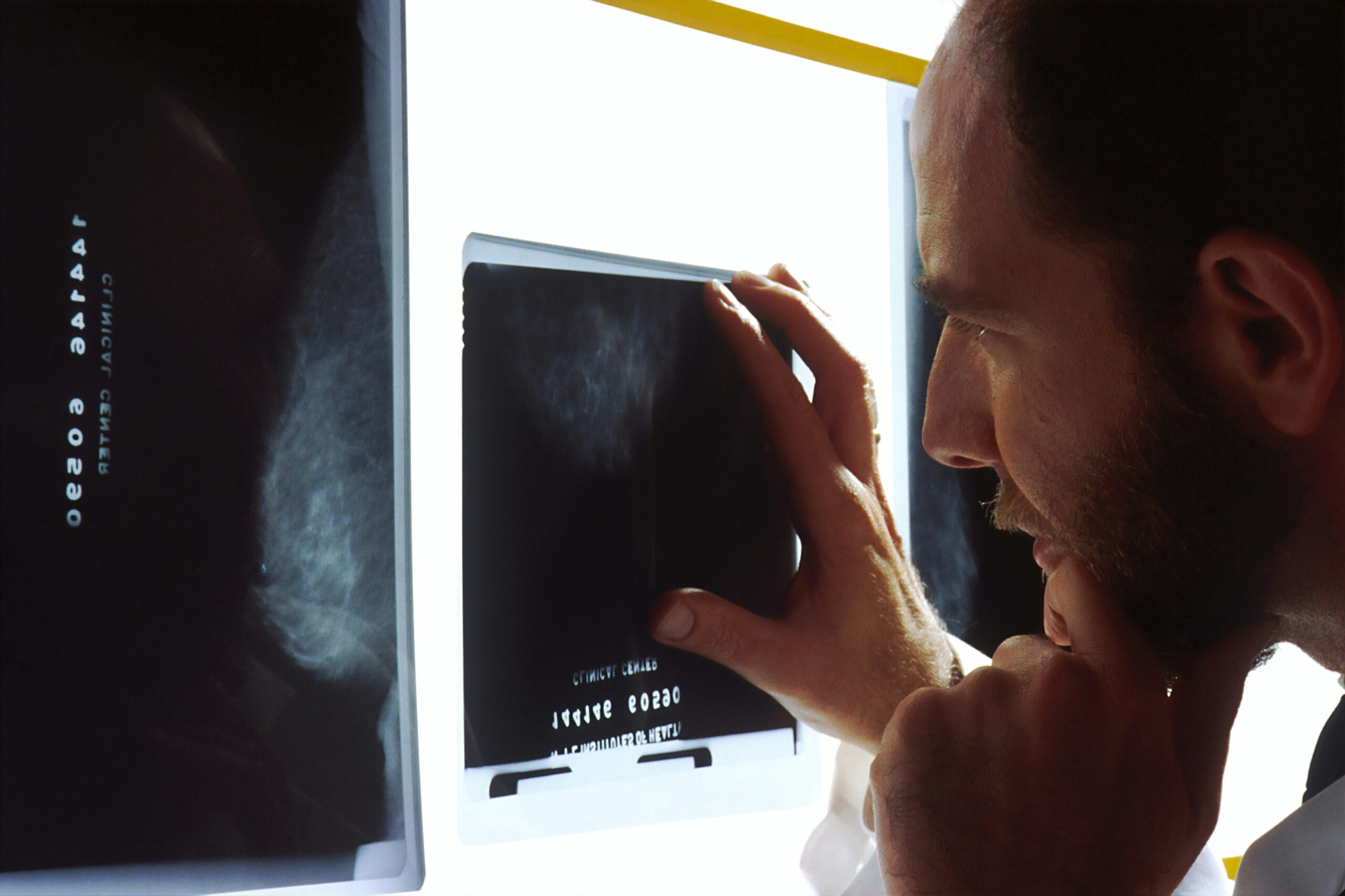 Better Way To Monitor Drug Therapy At Home