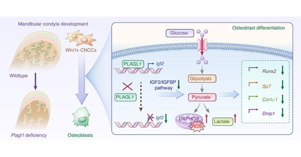 Key Gene Axis Controls Postnatal Condyle Development
