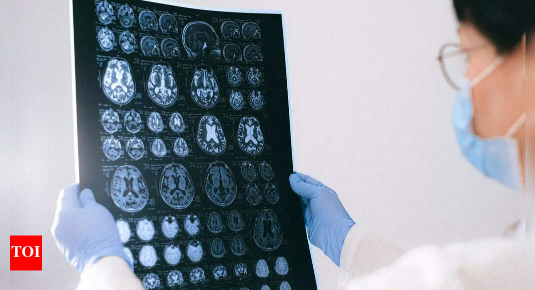 The shocking reason Alzheimer’s targets women more than men; scientists reveal |