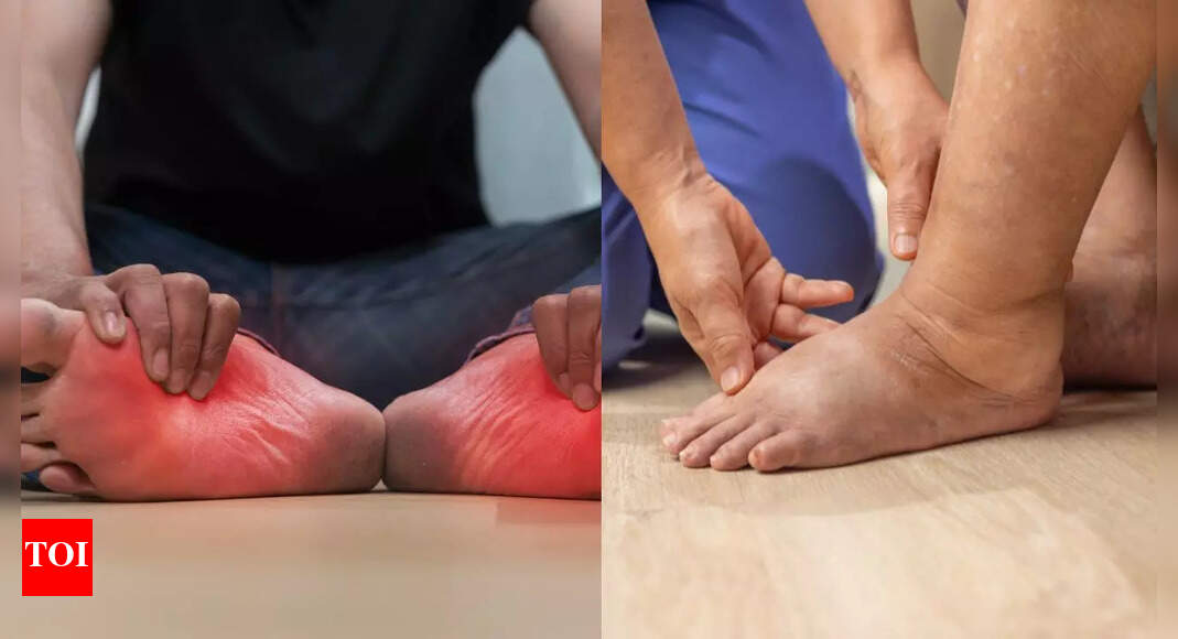 Early symptoms of lung cancer that show up in your legs and feet: Swelling, pain, and colour changes to watch for |