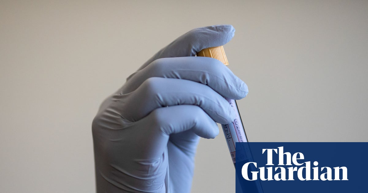 Experts consider ‘targeted’ prostate cancer screening to reduce UK deaths | Health