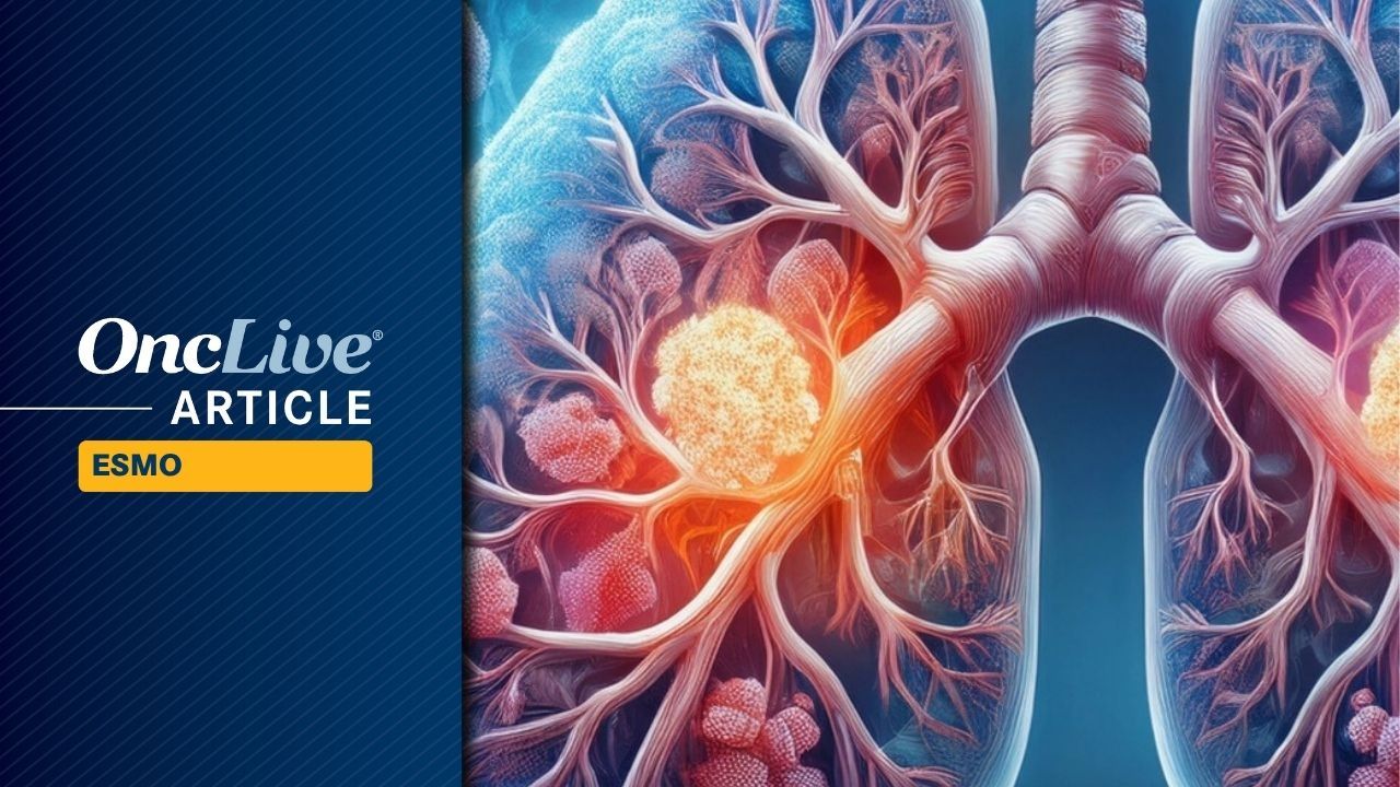 Ivonescimab Plus Chemo Might Be a New SOC in Advanced Squamous NSCLC