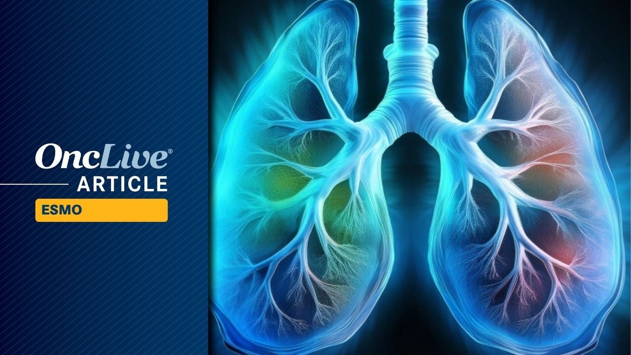 Adjuvant Alectinib Impresses in Updated ALINA Results for ALK+ NSCLC
