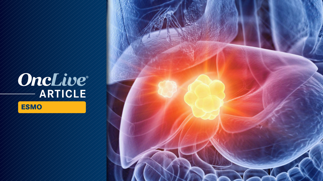 Tiragolumab/Atezolizumab/Bevacizumab Fails to Significantly Improve PFS in Advanced/Metastatic HCC
