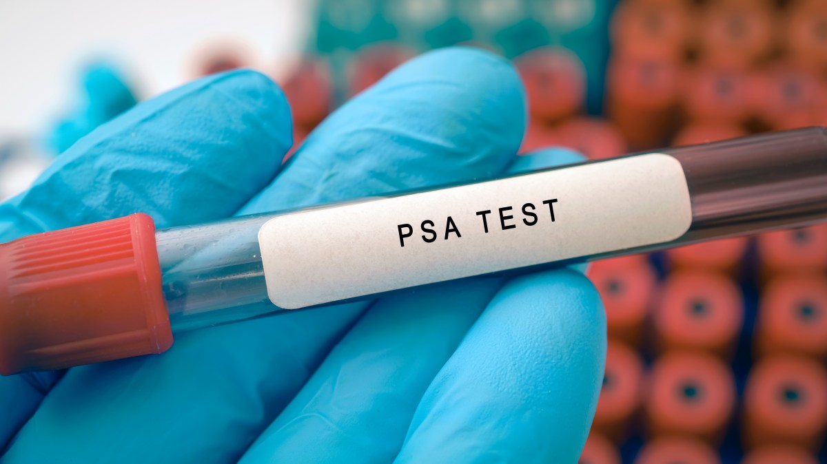 Charities warn of disappointment if prostate cancer screening rejected – The Times