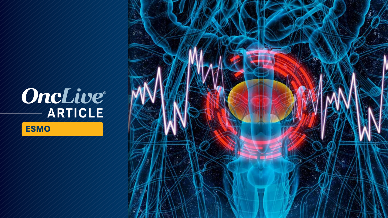 SunRISe-4 Data Support Role for Neoadjuvant Gemcitabine Intravesical System Plus Cetrelimab in MIBC