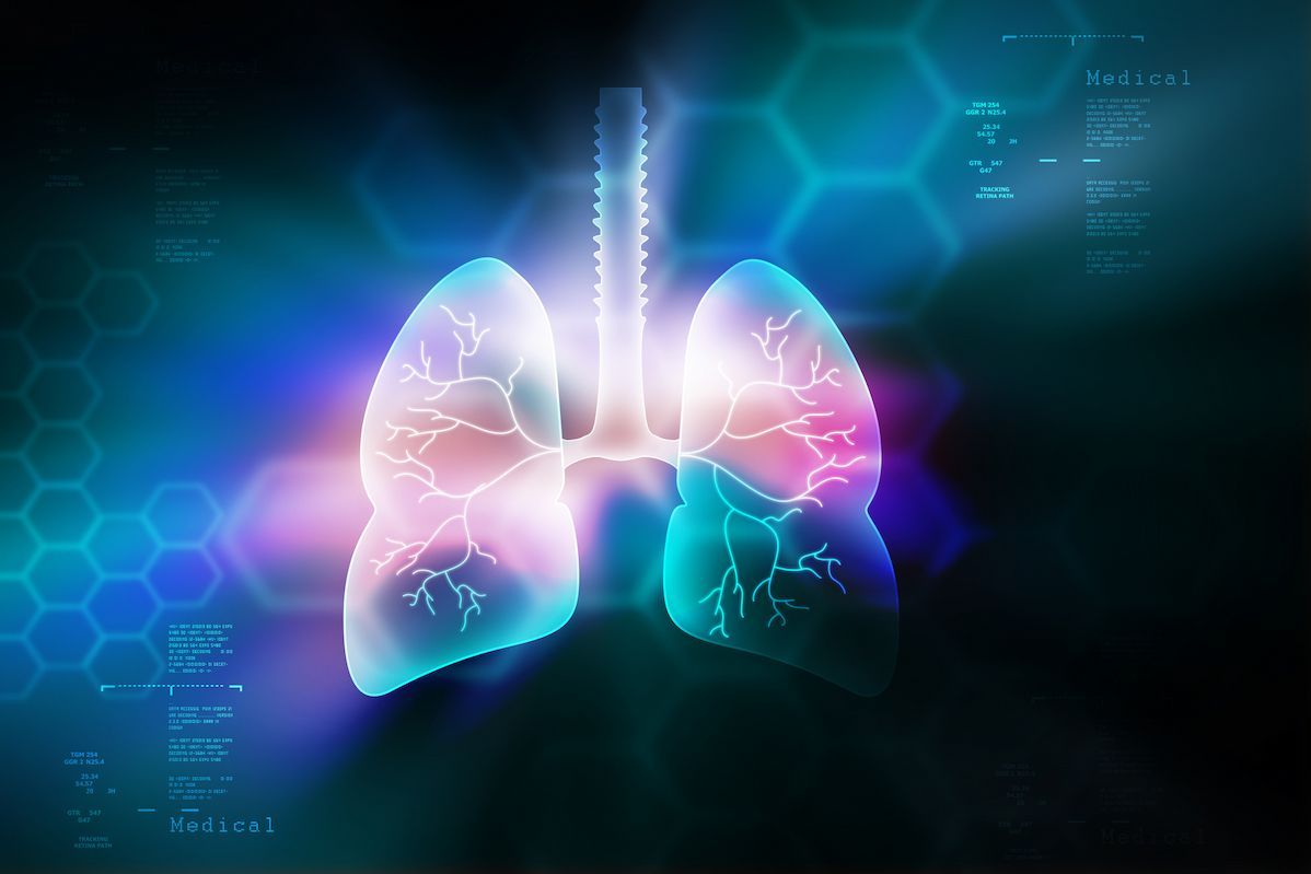 Tarlatamab Plus Chemo/IO Regimens Are Safe, Elicit Responses in ES-SCLC