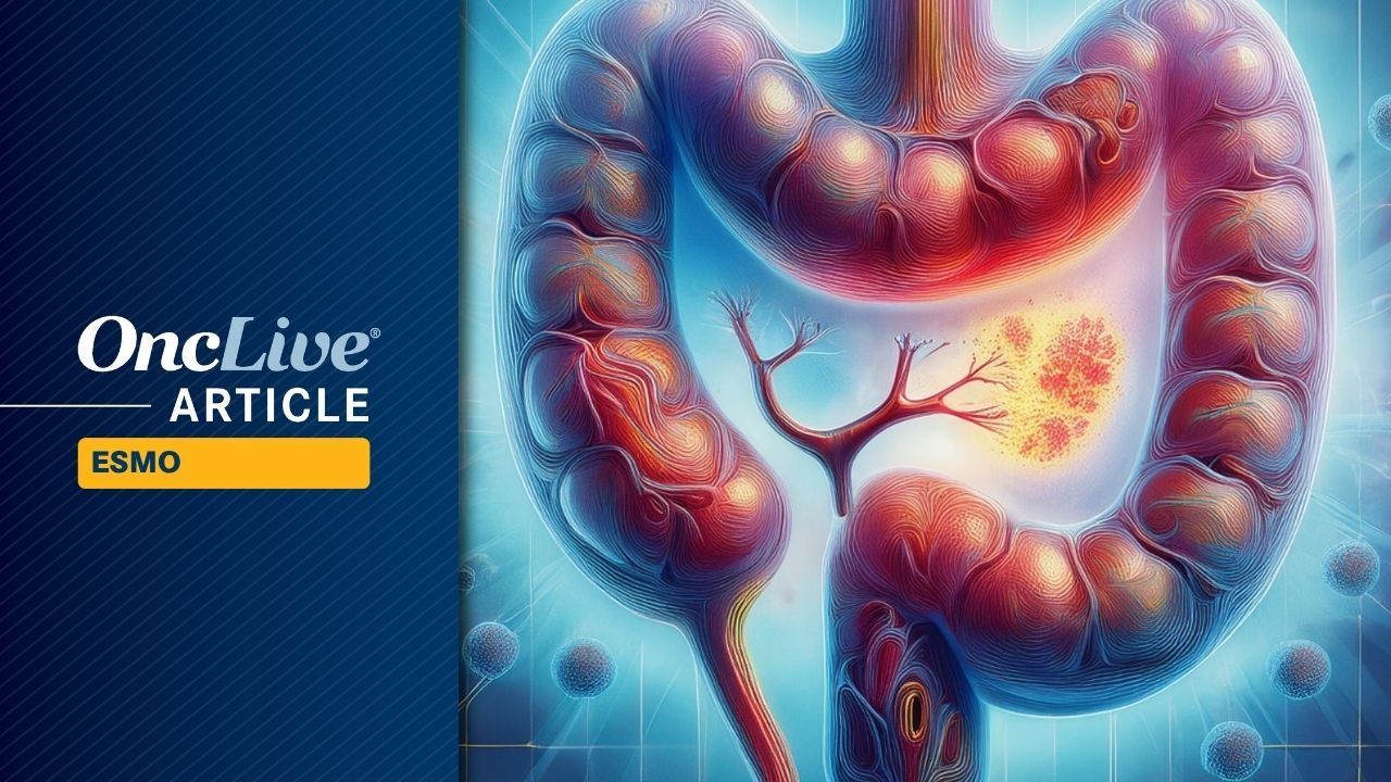 Sirexatamab Plus Bevacizumab/Chemo Improves Outcomes in DKK1-High mCRC