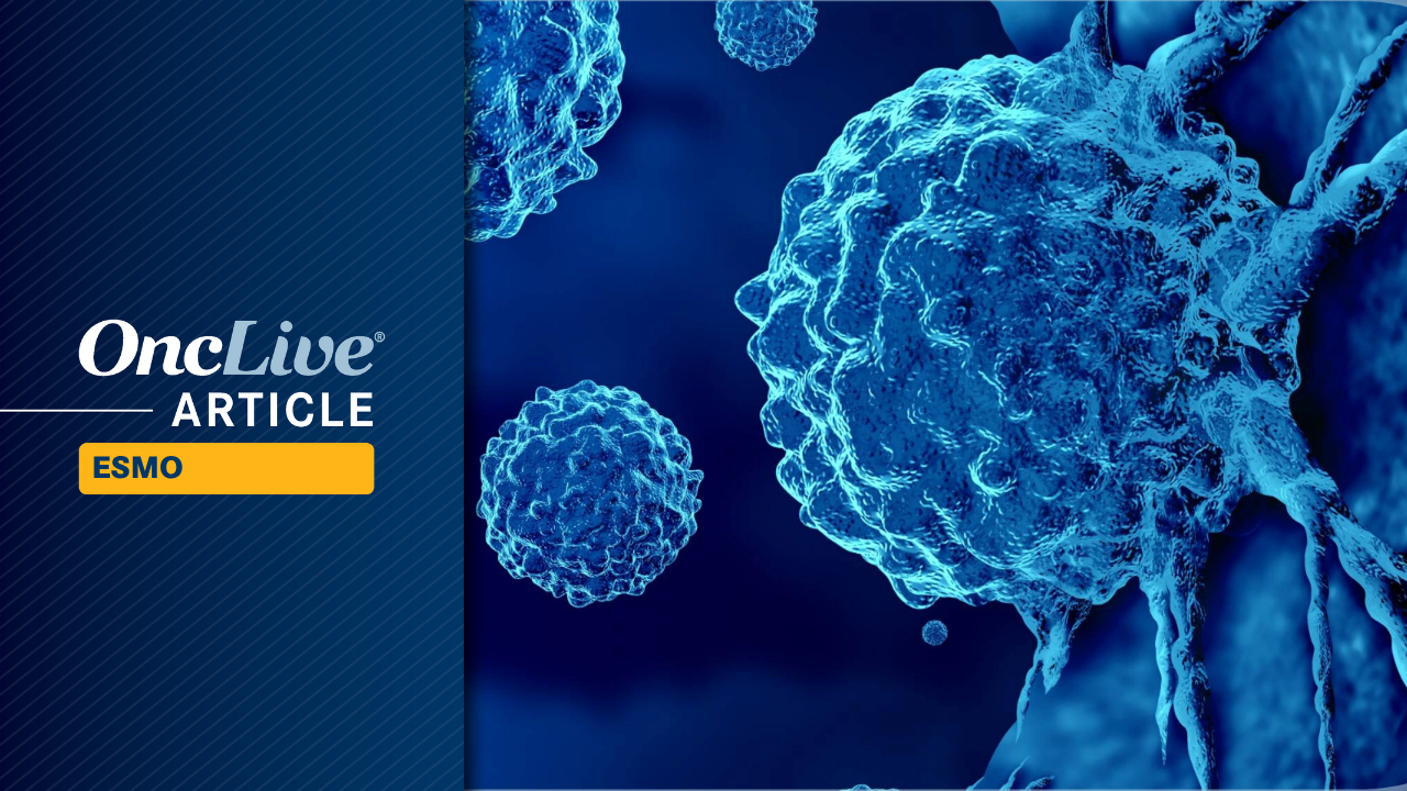 Lenvatinib Plus Pembrolizumab and Chemotherapy Fails to Improve OS in Advanced ESCC