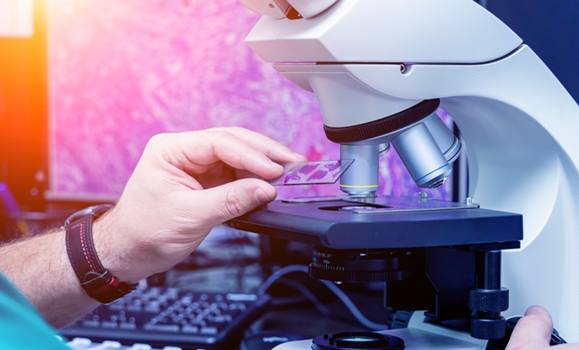 Optimising Prostate Biopsy Strategies for TZ Tumours