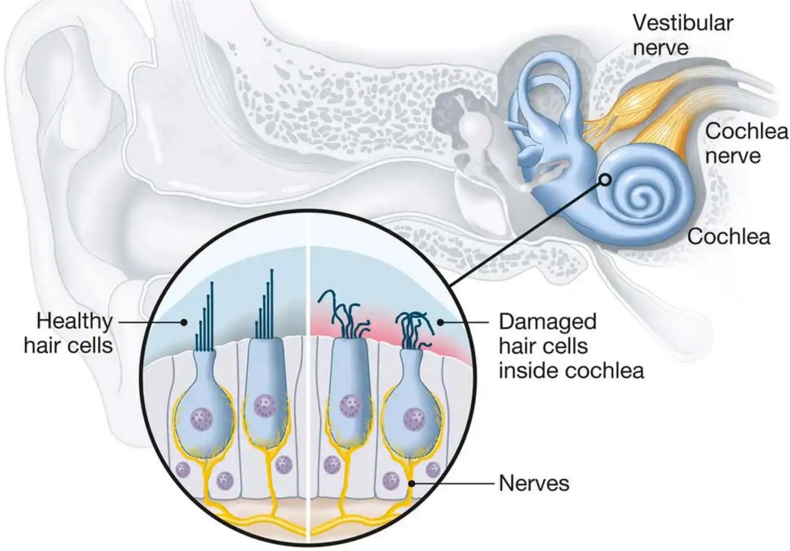 Audiological and radiological diagnosis of sensorineural hearing loss in Africa | Egyptian Journal of Radiology and Nuclear Medicine