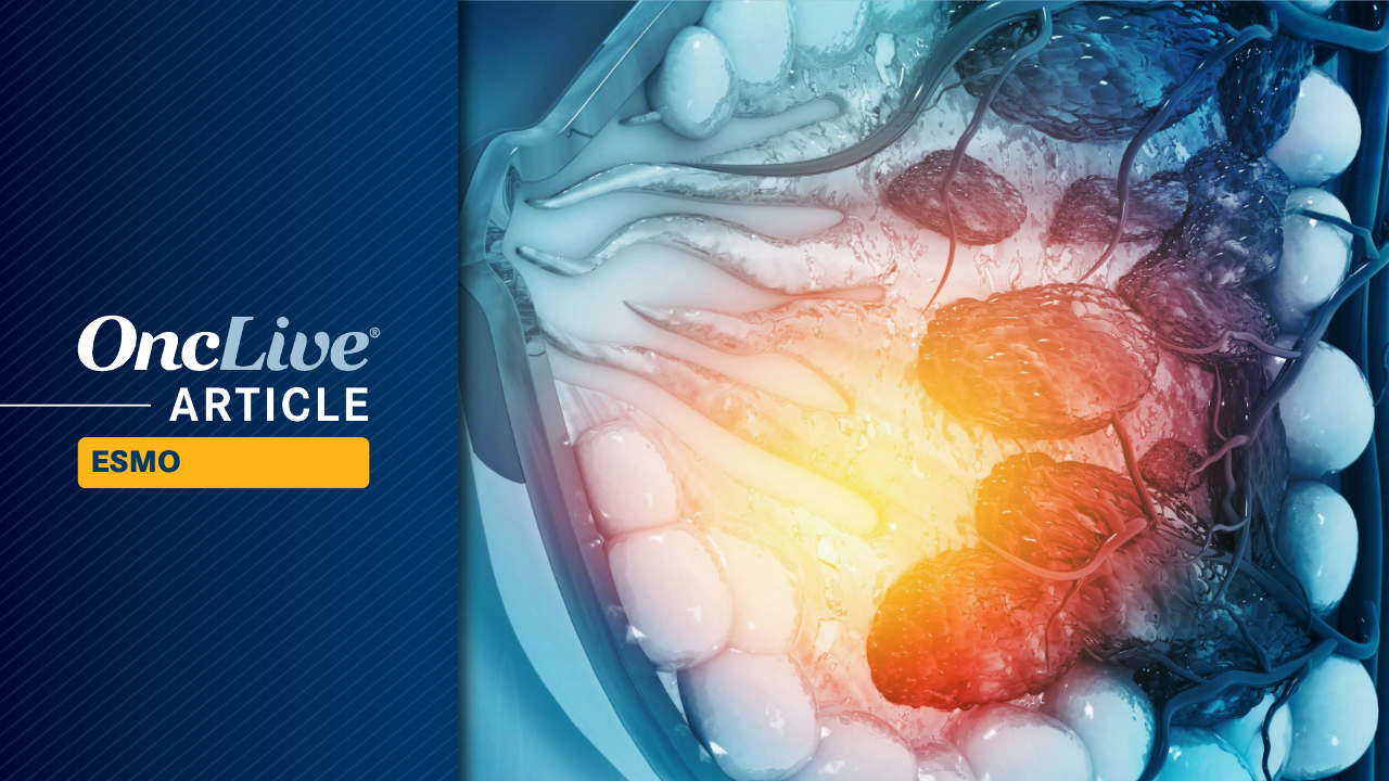 Abemaciclib Plus Endocrine Therapy Provides OS Benefit in HR+/HER2-Negative Breast Cancer