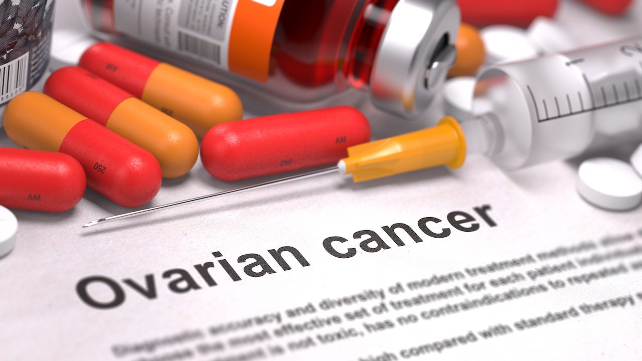 Cytokines Linked With Drug Resistance in Ovarian Cancer, but Underlying Mechanisms Remain Unclear