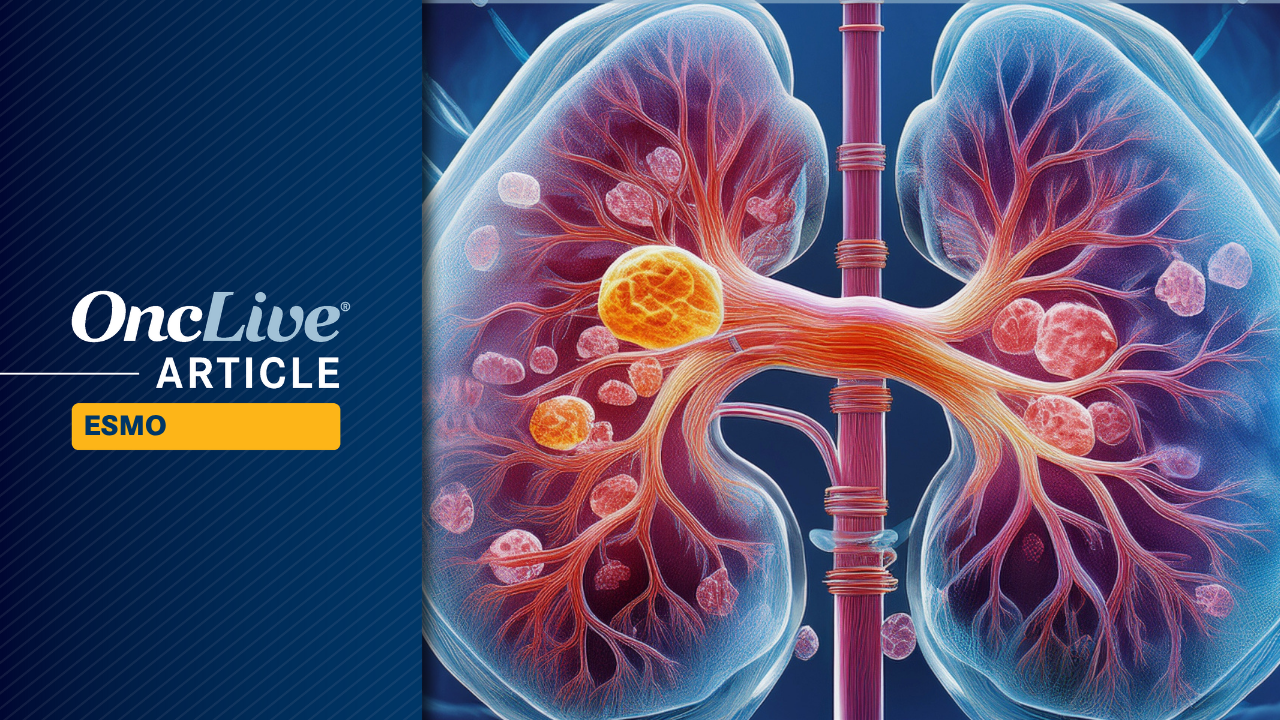 Fruquintinib Plus Sintilimab Improves PFS in Advanced RCC After First-Line VEGFR TKI Therapy