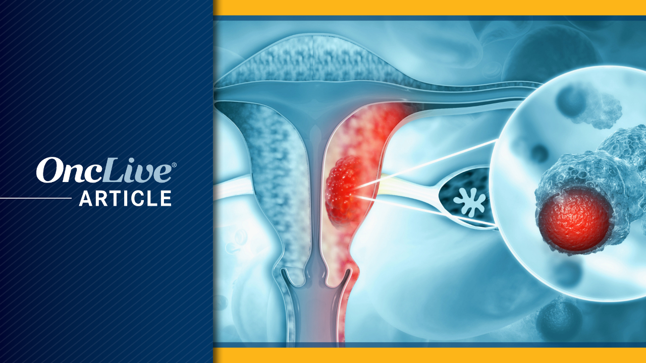 Adjuvant Chemoradiotherapy Yields 10-Year OS and RFS Advantages in High-Risk Endometrial Cancer