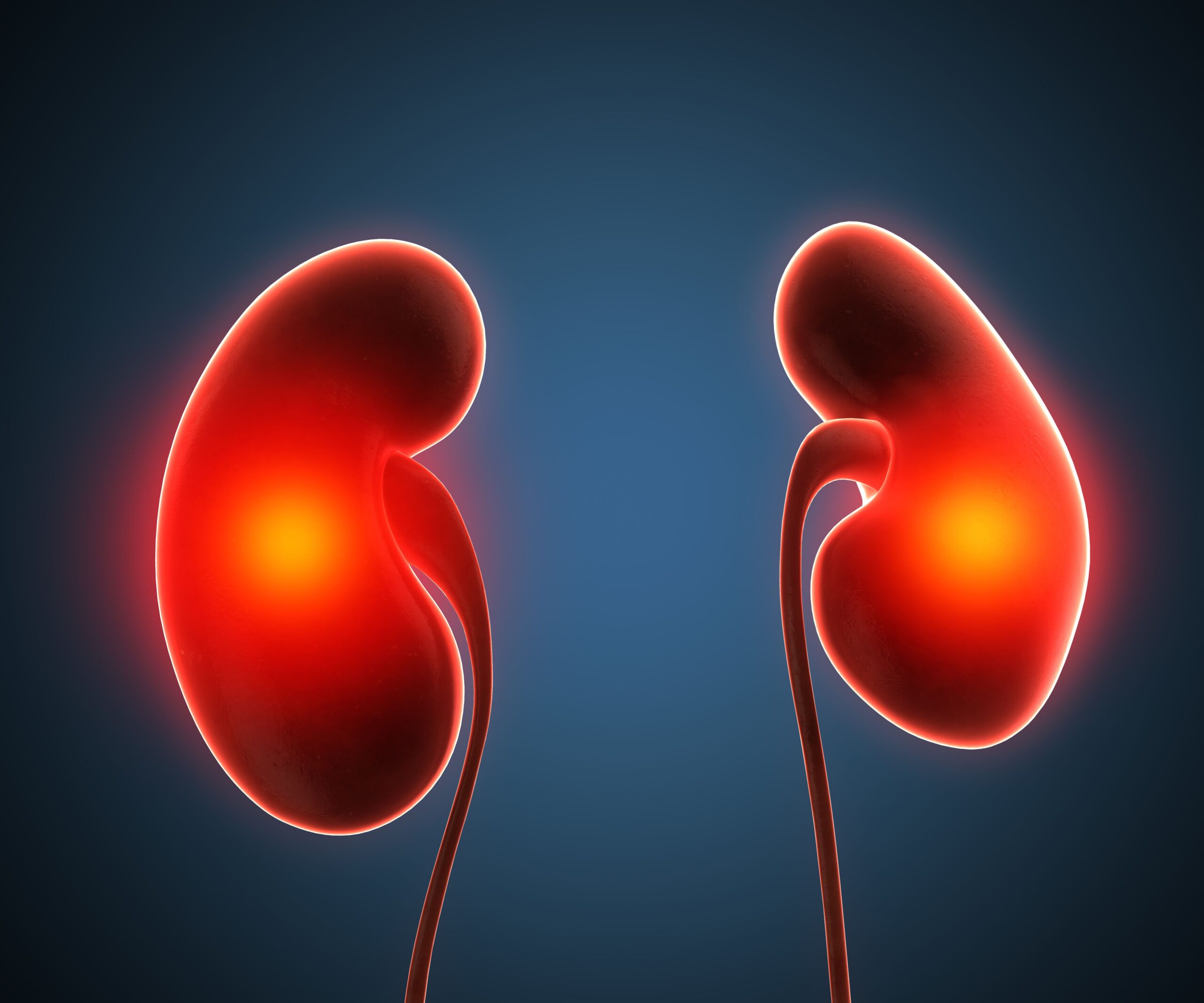 Casdatifan Monotherapy Achieves Clinical Activity in Late-Line Kidney Cancer