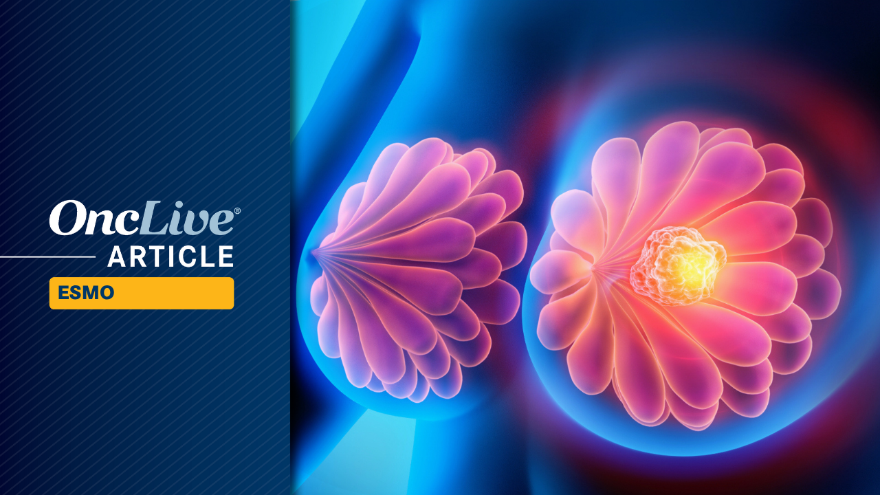 Neoadjuvant T-DXd Plus THP Yields pCR Benefit in High-Risk, HER2+ Early Breast Cancer