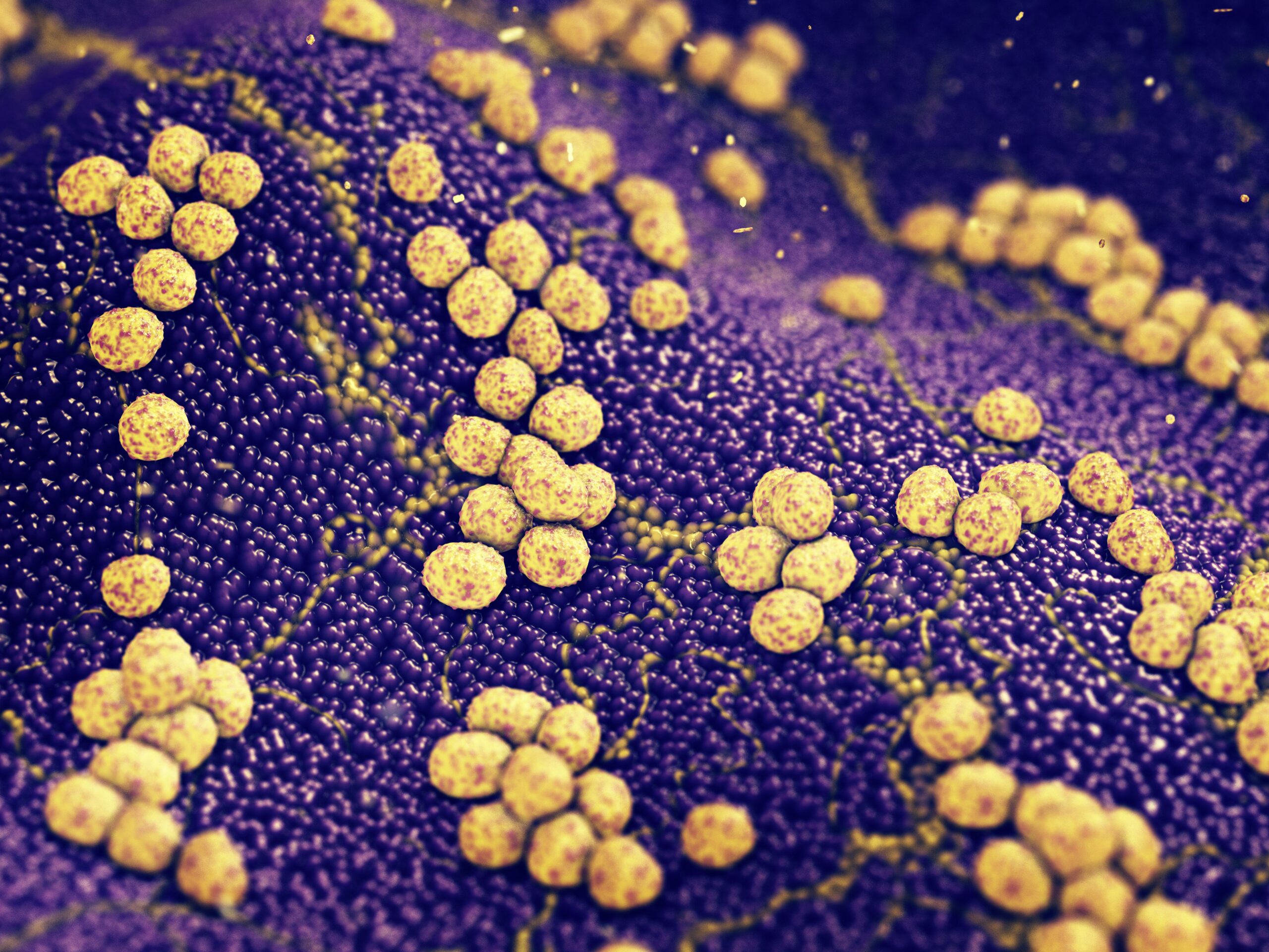 PCR boosts detection of bacteria in pediatric bone and joint infections