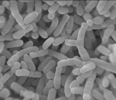 In chromosome of key biotech bacterium, different setups bring different strengths