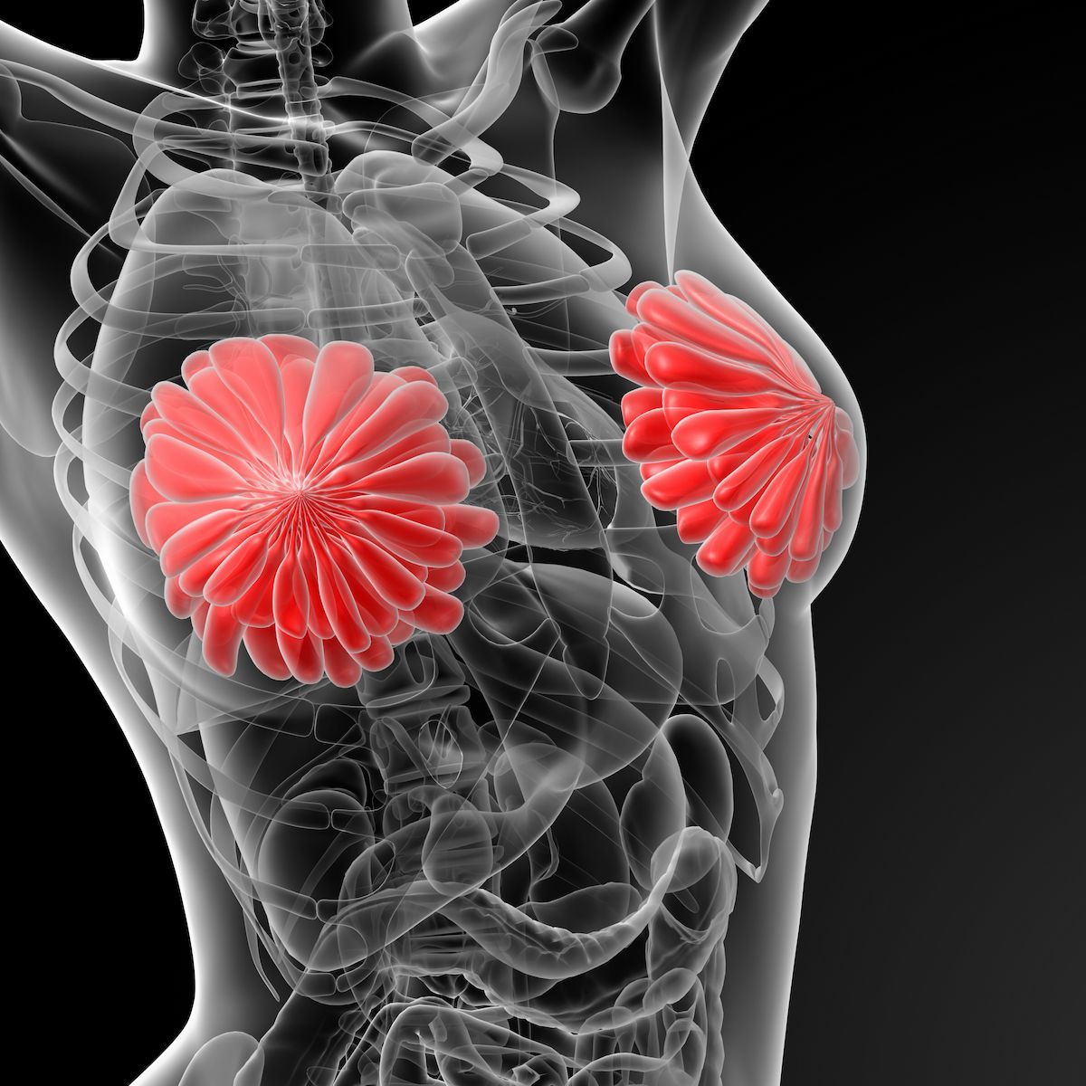 Subgroup Analysis Yields Clinically Meaningful Responses With T-DXd in HER2+ Breast Cancer