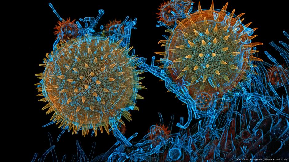 World photomicrography winners 2025: When science becomes art – dw.com