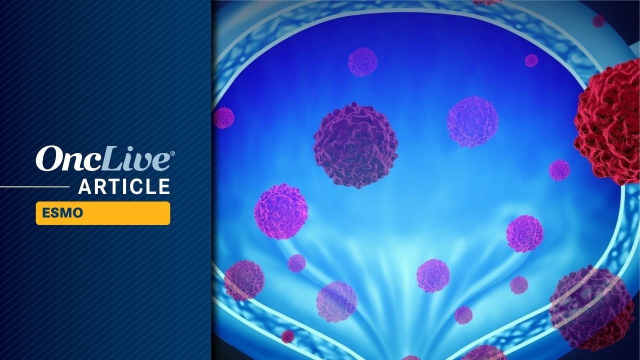 Dato-DXd Plus Rilvegostomig Elicits Activity in Cisplatin-Ineligible or Platinum-Pretreated Urothelial Cancer
