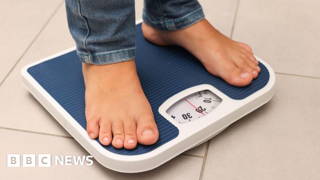Underweight and obese children cost NHS same, Oxford study finds